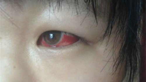 光觸媒除甲醛保護新裝修教室空氣，更保護孩子們