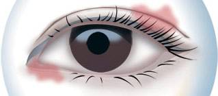 CBA***得分手發(fā)高燒吸氧0得分 教練：賓館房間新裝修，甲醛中毒導(dǎo)致的！