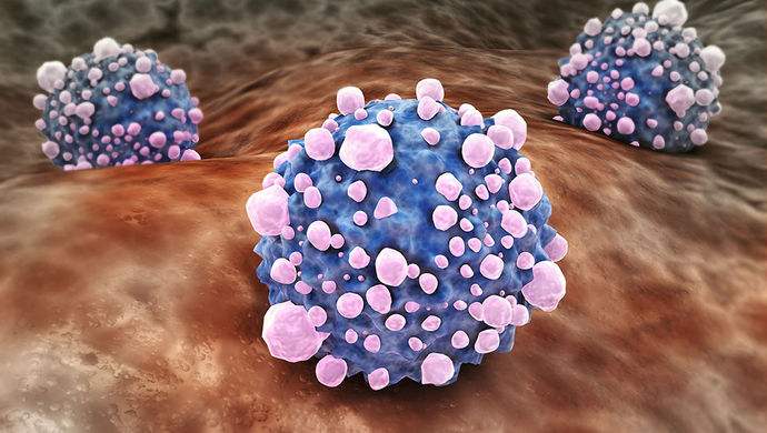 平時不注意甲醛超標(biāo)，50歲女子劇烈頭痛、惡心干嘔，一查已是癌癥晚期！