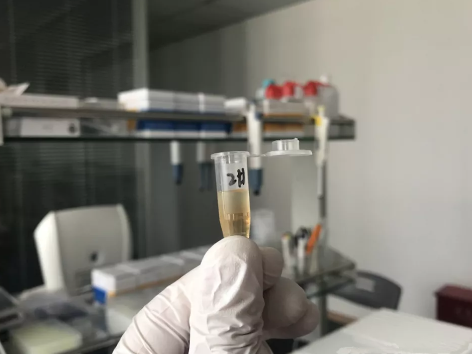 水煮花生含甲醛？實(shí)測(cè)多家燒烤店結(jié)果太可怕！