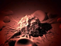 癌癥、白血病越來(lái)越多，是因?yàn)闀r(shí)代在進(jìn)步而導(dǎo)致的嗎？