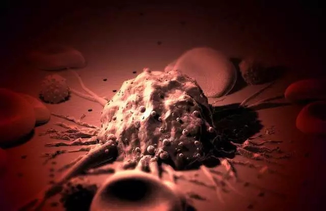 癌癥、白血病越來越多，是因?yàn)闀r(shí)代在進(jìn)步而導(dǎo)致的嗎？